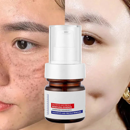 LOVILDS⚡Rescate iluminador en 5 segundos: ¡Las manchas oscuras desaparecen, las imperfecciones se atenúan y la piel luce radiante!