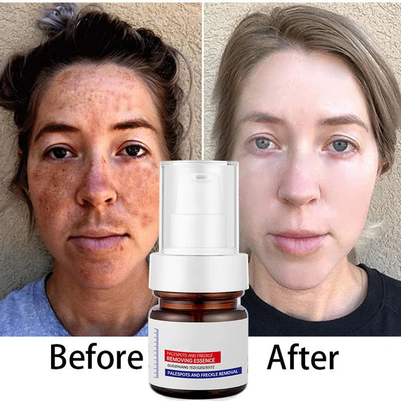 LOVILDS⚡Rescate iluminador en 5 segundos: ¡Las manchas oscuras desaparecen, las imperfecciones se atenúan y la piel luce radiante!