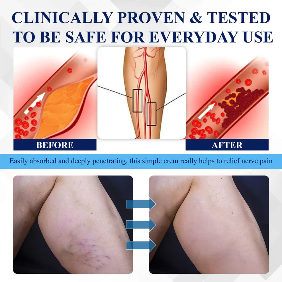 ¡OFERTA PAGA 1 LLEVA 2 NOVARX®  - CREMAS PARA EL ALIVIO DE LA NEUROPATIA, ARTICULACIONES Y LESIONES!