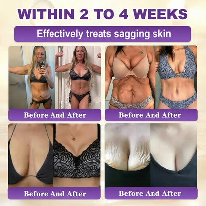 QIAWI® Biotin 10 en 1 Crema Restauradora de la Piel