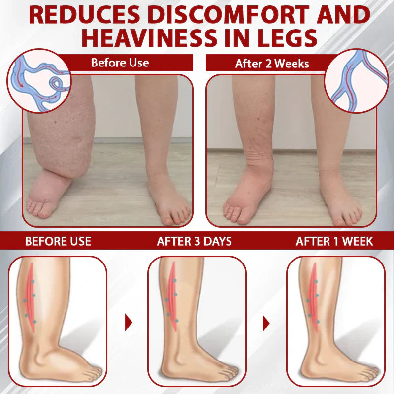 NovaRX® - Fluidgel de vino rojo para aliviar el edema