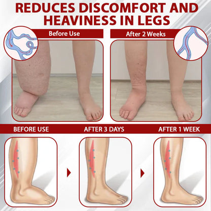 NovaRX® - Fluidgel de vino rojo para aliviar el edema