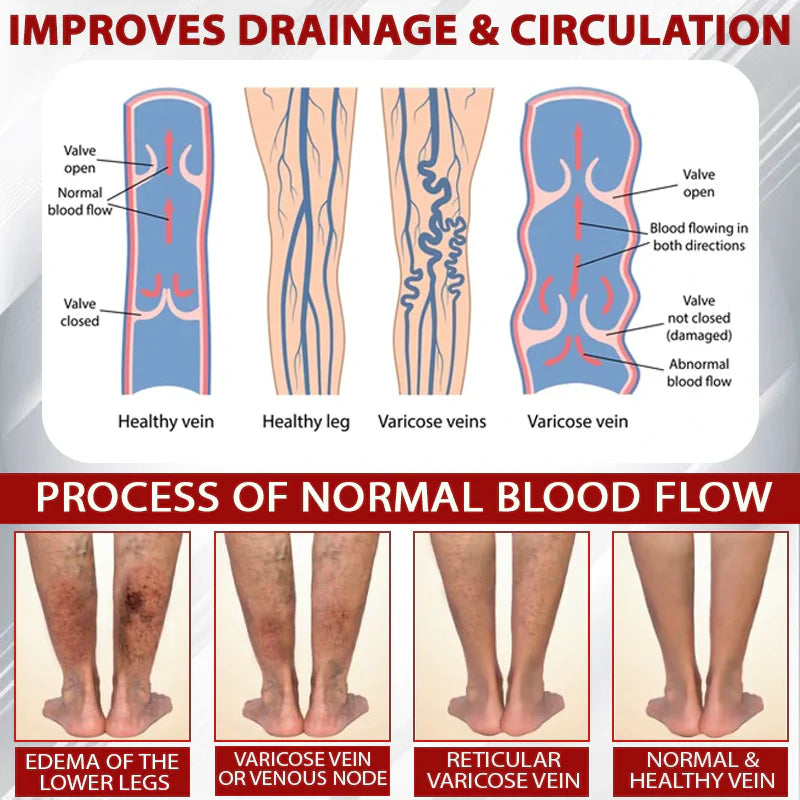 NovaRX® - Fluidgel de vino rojo para aliviar el edema