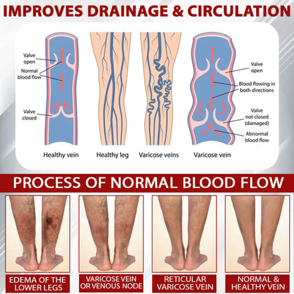 NovaRX® - Fluidgel de vino rojo para aliviar el edema