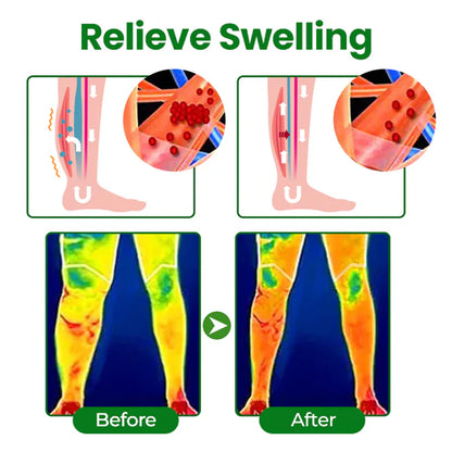 Timilk® VenoLift Spray para el alivio de piernas con edemas