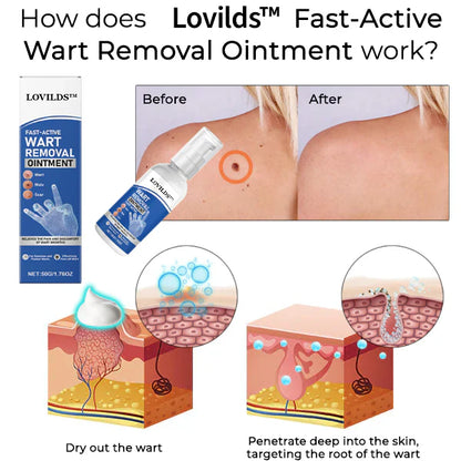 ¡PROMO 2X1 🔥𝑳𝑶𝑽𝑰𝑳𝑫𝑺™ ! Removedor de verrugas dermatológico