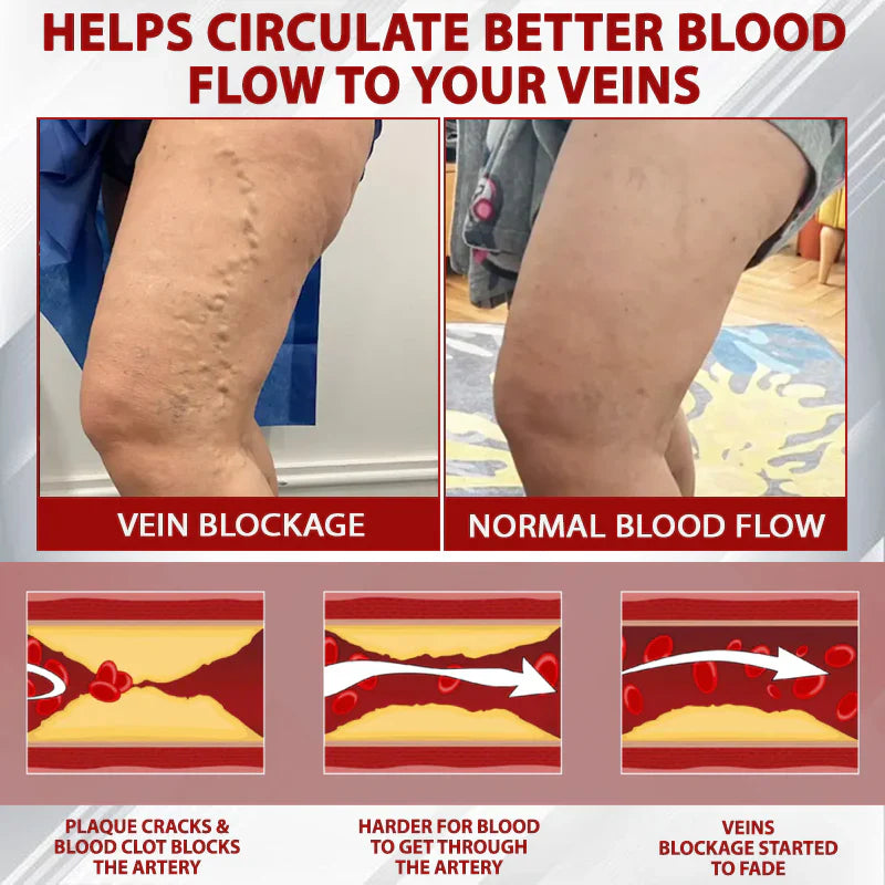 NovaRX® - Fluidgel de vino rojo para aliviar el edema