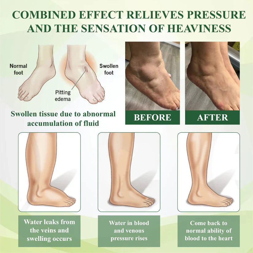 NovaRX® FlowBoost Roll-on Herbal para Drenar Edema