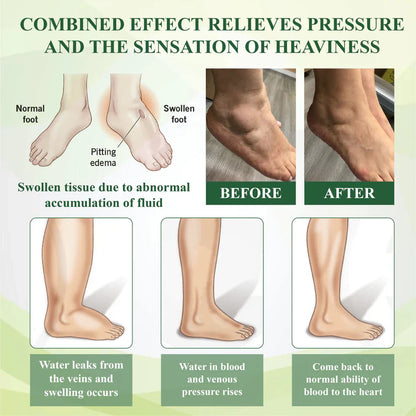 NovaRX® FlowBoost Roll-on Herbal para Drenar Edema