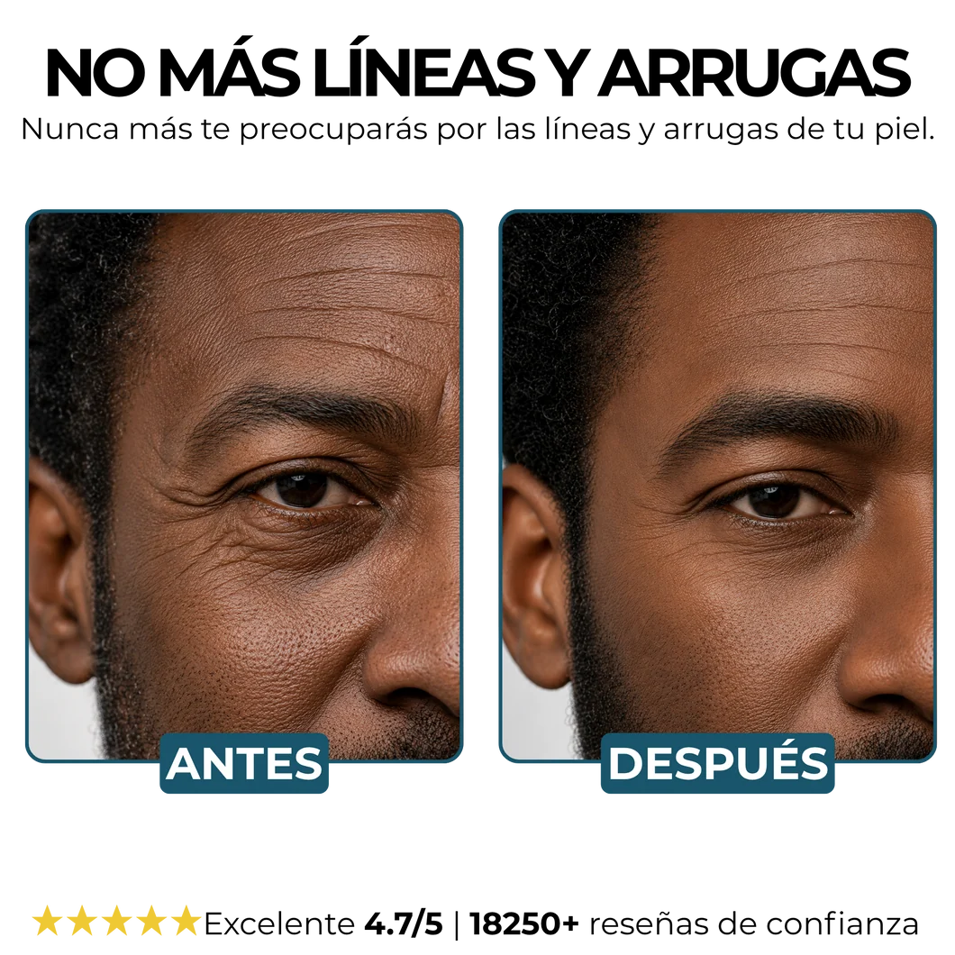 Morge Skin Visiblemente Mas Joven En Dos Semanas 🕶️