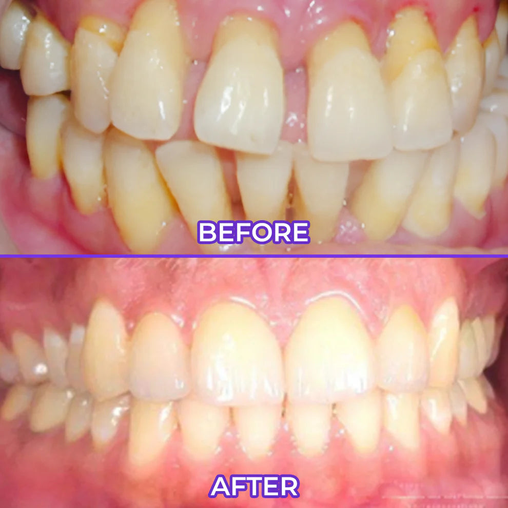 Pasta dental con flúor Biancat® SensiGum