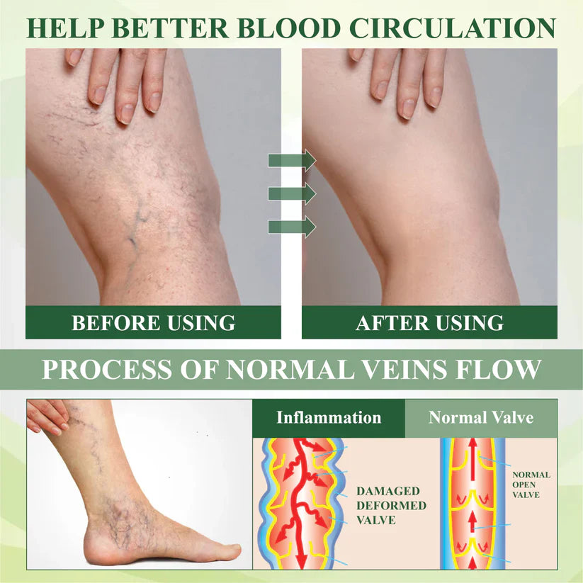 NovaRX® FlowBoost Roll-on Herbal para Drenar Edema