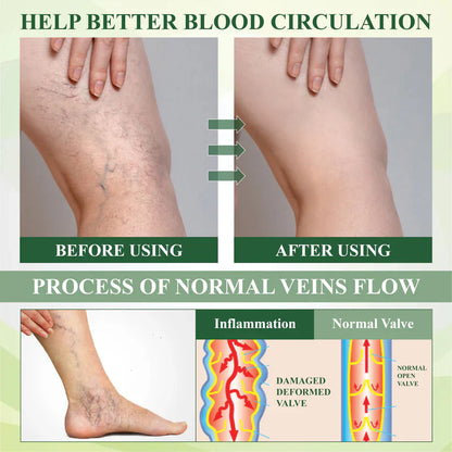NovaRX® FlowBoost Roll-on Herbal para Drenar Edema