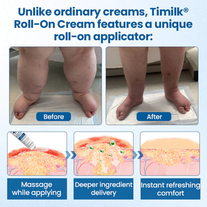 ¡OFERTA 2 X 1! Timilk® Roll-on Lymphora para el alivio de la hinchazón