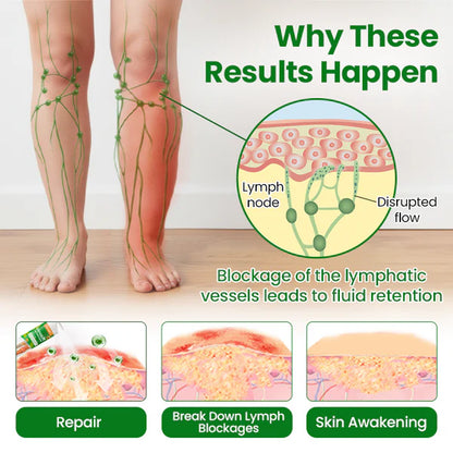 Timilk® VenoLift Spray para el alivio de piernas con edemas