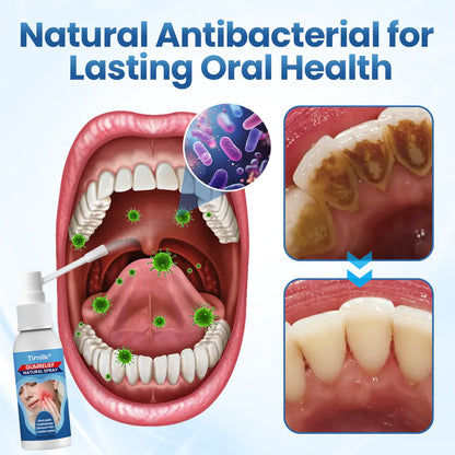 Timilk® - Spray natural para aliviar las encías