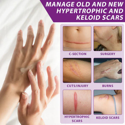 ¡OFERTA X3 GELS AVANZADOS PARA CICATRICES FACIALES Y CORPORALES ATTDX® NANOHEAL