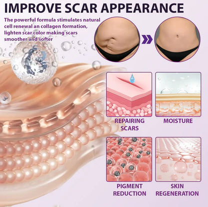 ¡OFERTA X3 GELS AVANZADOS PARA CICATRICES FACIALES Y CORPORALES ATTDX® NANOHEAL