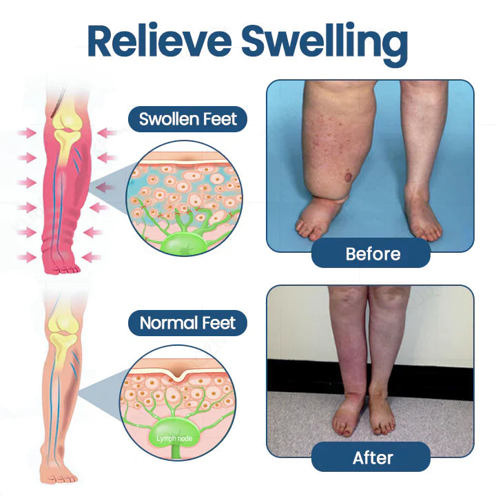 ¡Oferta x2 Cremas roll-on ATTDX®! Para drenaje linfático y alivio de la hinchazón