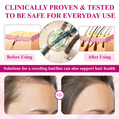 VitaGrowth® - Cápsulas para el crecimiento y engrozamiento del cabello