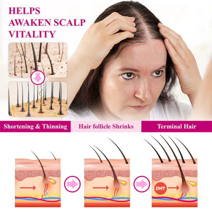 VitaGrowth® - Cápsulas para el crecimiento y engrozamiento del cabello