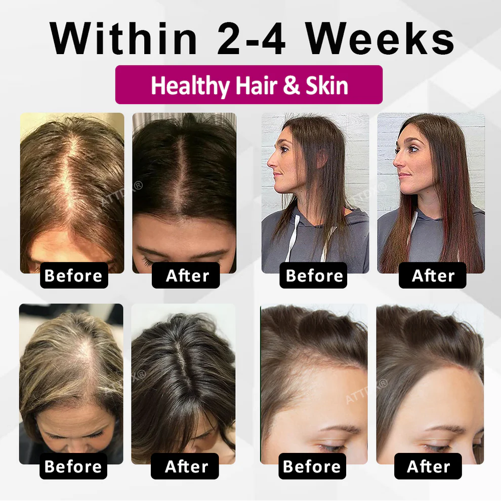 VitaGrowth® - Cápsulas para el crecimiento y engrozamiento del cabello