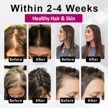 VitaGrowth® - Cápsulas para el crecimiento y engrozamiento del cabello