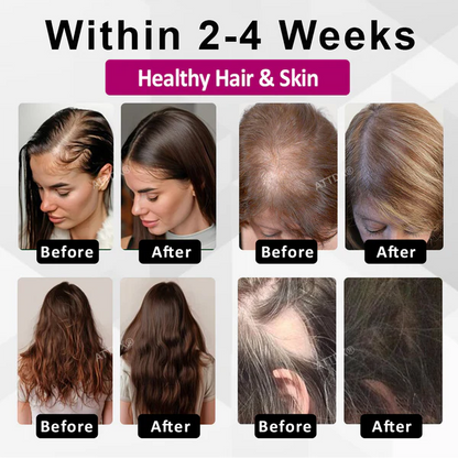 VitaGrowth® - Cápsulas para el crecimiento y engrozamiento del cabello