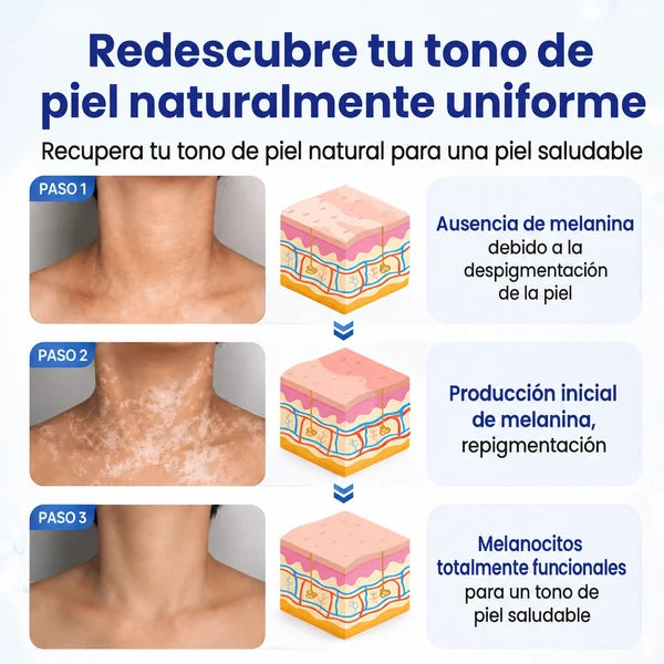 VitiRepair - Spray avanzado para el vitiligo y parches blancos
