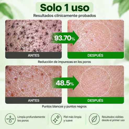 ProctoEase - Gel para hemorroides con barrera protectora avanzada