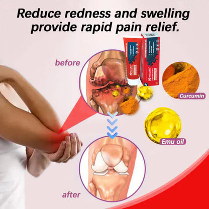 Gel de Enfriamiento Rápido Para la Osteoartritis ¡LLEVA 2 X $79.900!