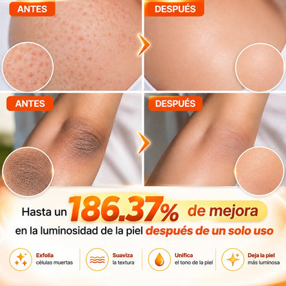 Dr.Melaxin - Spray Exfoliante De Ácido Kójico Y Cúrcuma