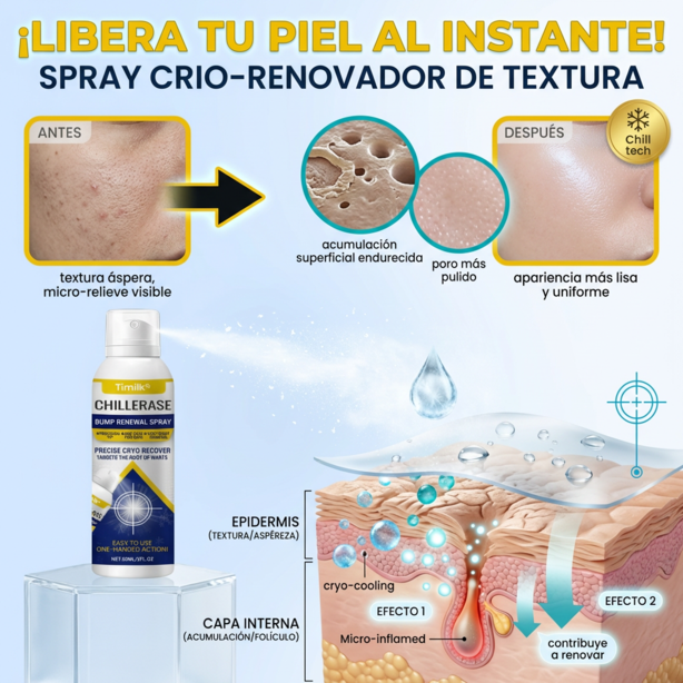 Timilk® ChillErase - Spray revitalizador de Verrugas