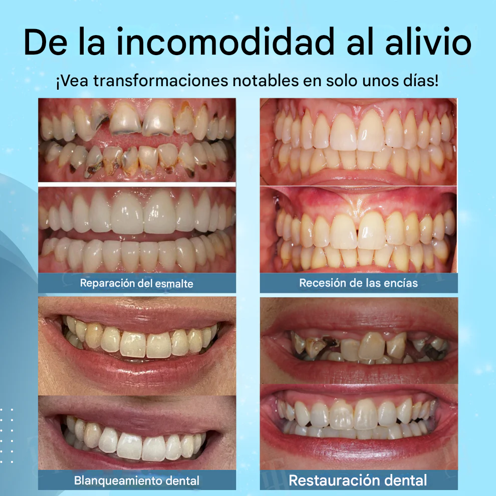 AEXZR® Gel de Sutura de Encías No Quirúrgico