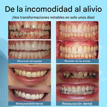 AEXZR® Gel de Sutura de Encías No Quirúrgico