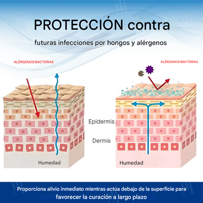 Crema Fivfivgo® para el tratamiento de la picazón en el escroto