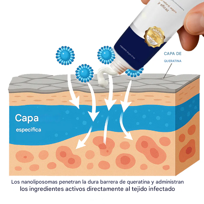 Crema removedora de verrugas genitales Cvreoz®