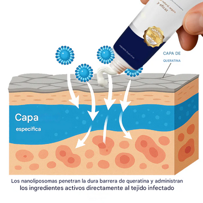 Crema removedora de verrugas genitales Cvreoz®