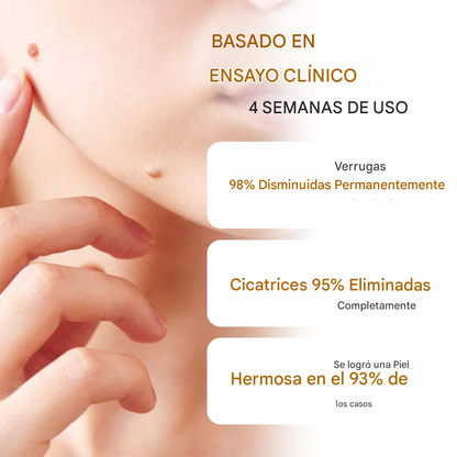 Gel avanzado para eliminar lunares y manchas Fivfivgo® DermaErase