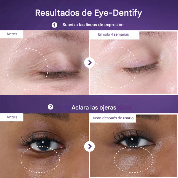 Crema para el contorno de ojos Numbuzin No.9 NAD+ Retinol Volumetox
