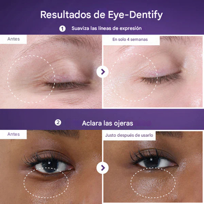 Crema para el contorno de ojos Numbuzin No.9 NAD+ Retinol Volumetox
