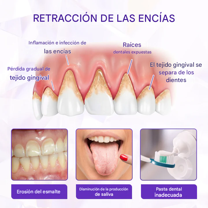 Pasta dental con flúor Biancat® SensiGum