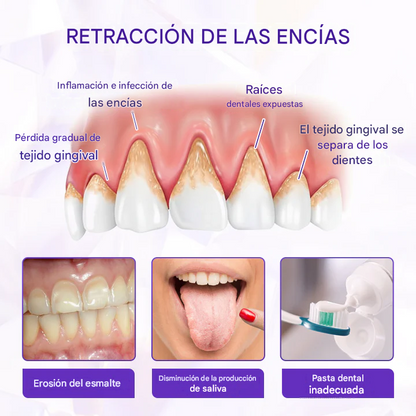 Pasta dental con flúor Biancat® SensiGum