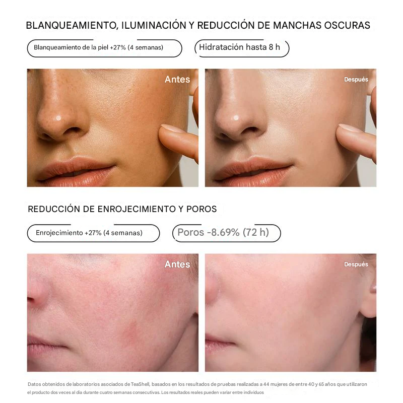 Sérum blanqueador con 5 % de niacinamida🌿|Reduce las manchas oscuras, ilumina la piel, apto para pieles sensibles