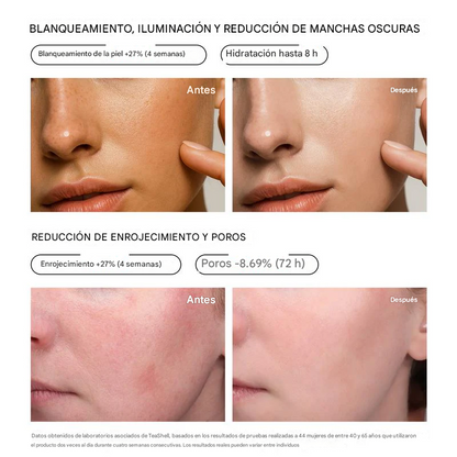 Sérum blanqueador con 5 % de niacinamida🌿|Reduce las manchas oscuras, ilumina la piel, apto para pieles sensibles