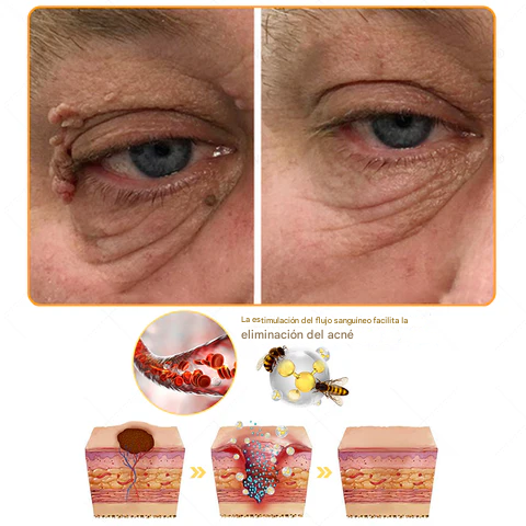Crema facial multiusos todo en uno Fivfivgo™ de 7 días