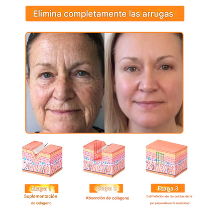 Crema facial multiusos todo en uno Fivfivgo™ de 7 días