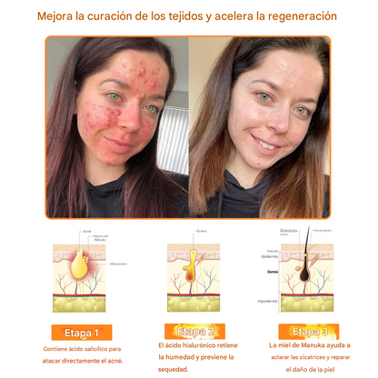 Crema facial multiusos todo en uno Fivfivgo™ de 7 días