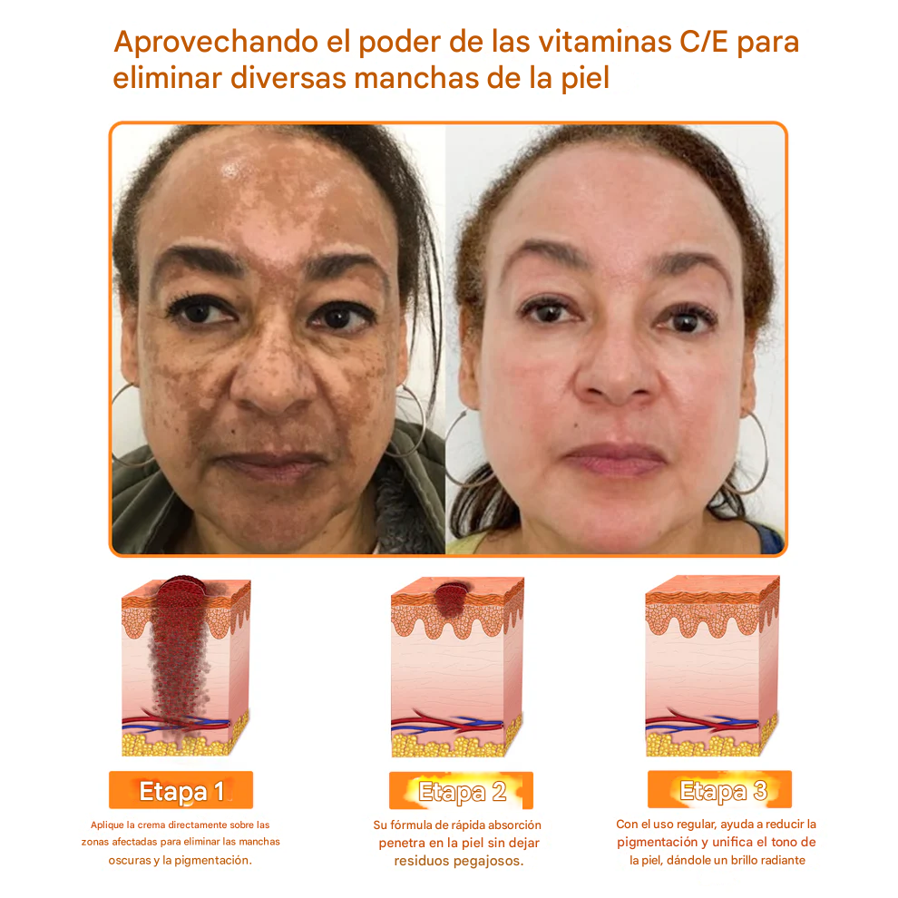 Crema facial multiusos todo en uno Fivfivgo™ de 7 días