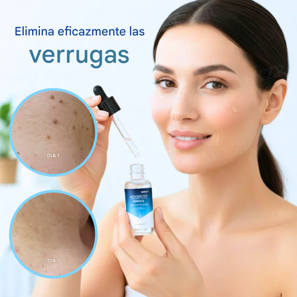 RZXEA™ Esencia avanzada para eliminar verrugas y marcas cutáneas ✨